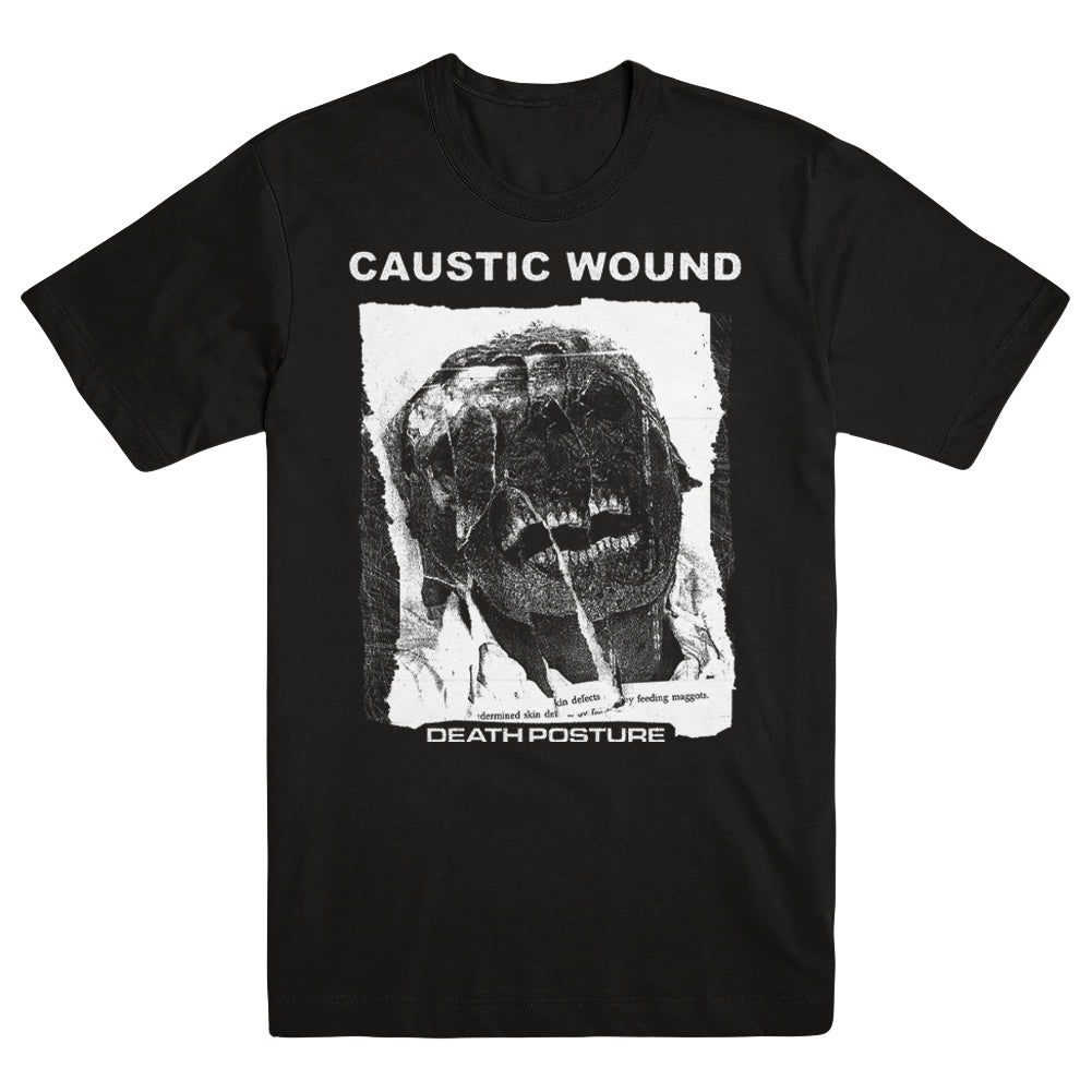 Caustic Wound Merch Death Posture Shirt Caustic Wound Shirt Fatherâ€™S Day Gifts For Boyfriend
